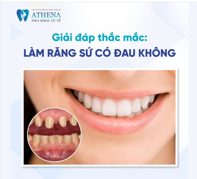 Làm răng sứ có đau không?