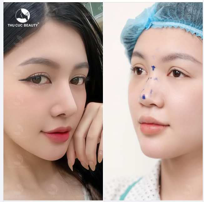 Chỉ 1 thay đổi nhỏ Gương mặt sắc nét, xinh đẹp hơn