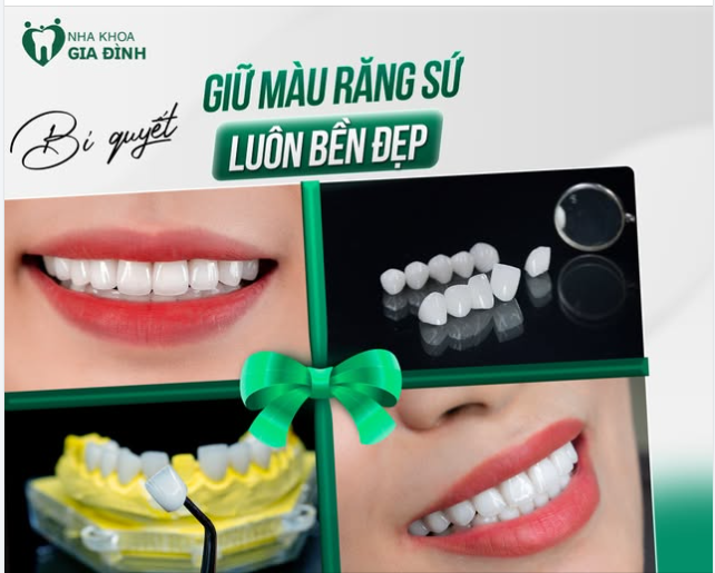 GIỮ MÀU RĂNG SỨ LUÔN BỀN ĐẸP CŨNG CẦN CÓ “BÍ QUYẾT” ĐÓ NHÉ!