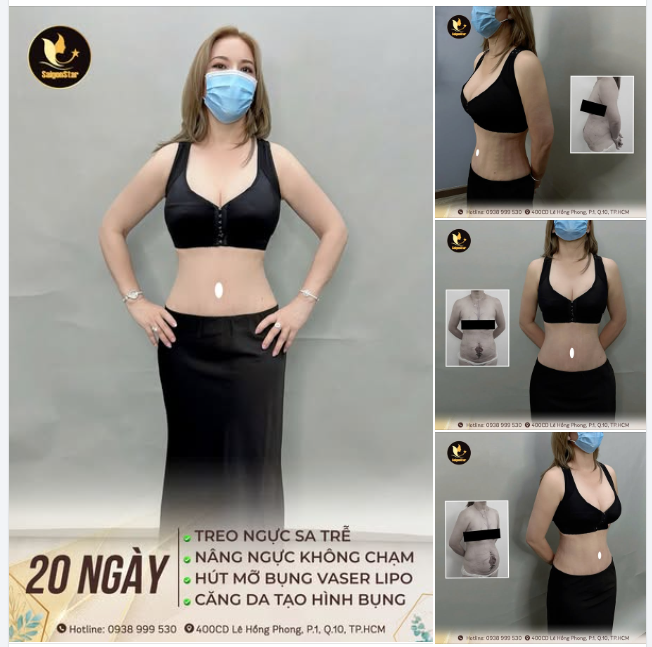 KẾT QUẢ 20 NGÀY ĐỘ DÁNG CÙNG SIÊU COMBO: