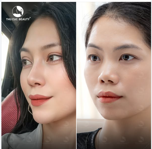 Bạn có nhận ra mình sau bức ảnh này không?