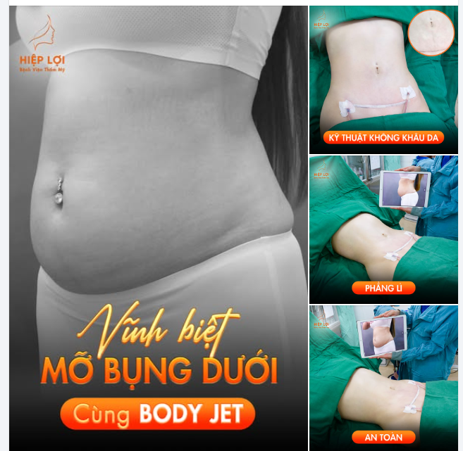 Công nghệ BODY JET là một bước ĐỘT PHÁ trong lĩnh vực thẩm mỹ, đặc biệt phù hợp cho những ai muốn loại bỏ mỡ bụng dưới một cách AN TOÀN, ÍT xâm lấn và KHÔNG đau đớn.