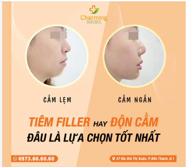 CẰM NGẮN, CẰM LẸM: TIÊM FILLER HAY ĐỘN CẰM, ĐÂU LÀ LỰA CHỌN TỐT NHẤT?
