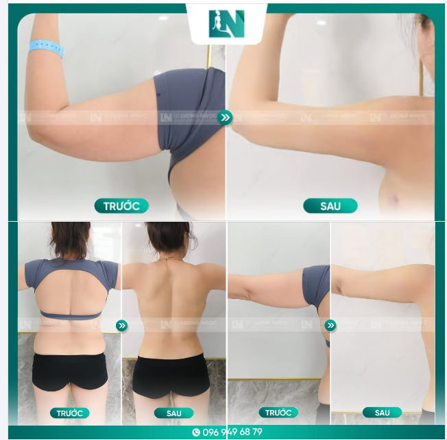 HOÀN THIỆN VÓC DÁNG MONG ƯỚC
