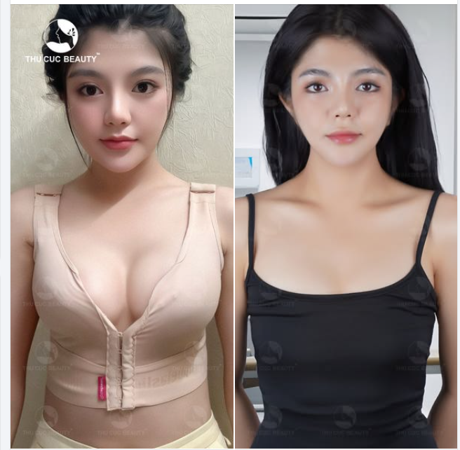 Hot girl Hải Miên đã lựa chọn thay đổi Còn bạn thì sao?