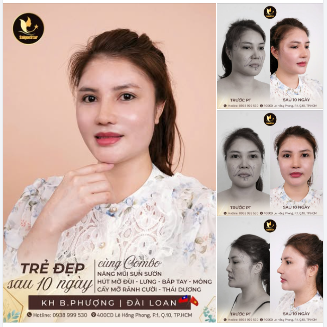 KHÁCH HÀNG U50 ĐẾN TỪ ĐÀI LOAN THÀNH CÔNG "ĐỘ SẮC" VỚI COMBO