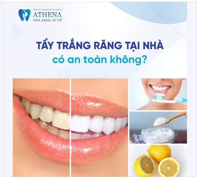 Tẩy trắng răng tại nhà có thực sự an toàn?