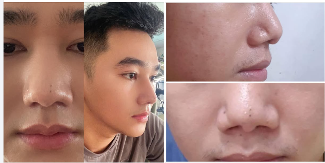 Mình thấy rất nhiều bạn gặp vấn đề giống mình và tự ti trong cuộc sống nên mình chia sẻ xíu cho mọi người có niềm tin hơn nha!