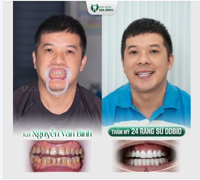 LÀM ĐẸP THÌ KHÔNG MÀNG KHOẢNG CÁCH!