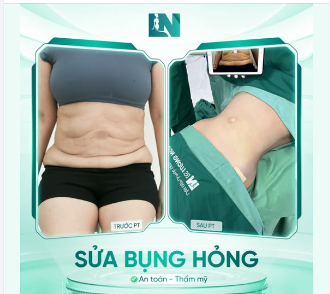 TIẾP TỤC SERIES GIẢI CỨU BỤNG HỎNG