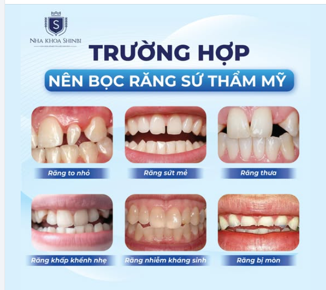 TRƯỜNG HỢP NÀO NÊN BỌC RĂNG SỨ??