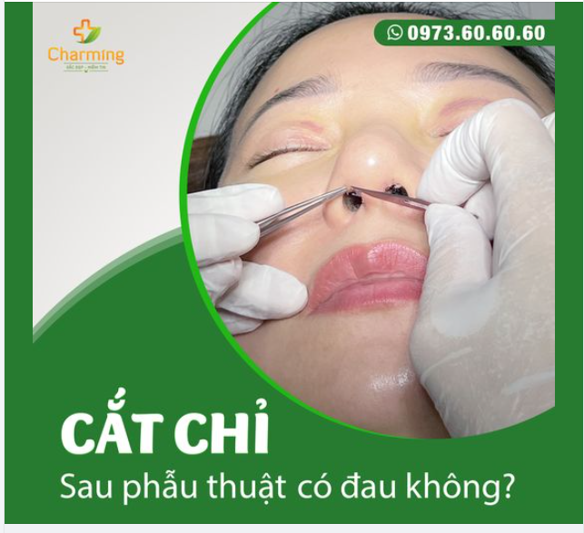 CẮT CHỈ SAU PHẪU THUẬT: CÓ ĐAU KHÔNG?