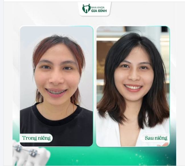 Al CHẲNG MUỐN MÌNH XINH - AI CHẲNG MUỐN THẬT LUNG LINH