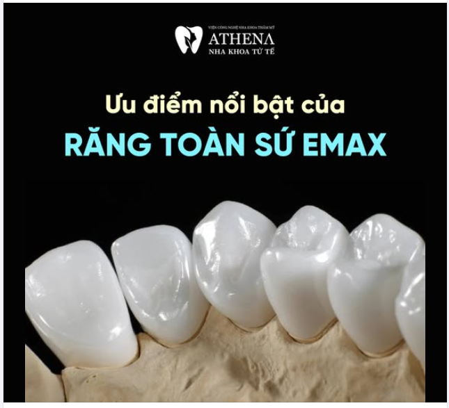 4 ưu điểm của Răng sứ E.Max