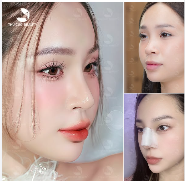 Nhìn vào bức ảnh bạn đã ưng dáng mũi này chưa?