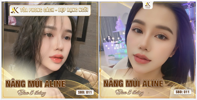 CUỘC THI ẢNH "TỎA PHONG CÁCH - ĐẸP RẠNG NGỜI"  Số báo danh: 011
