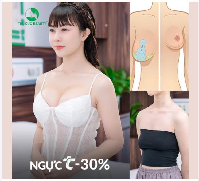 Sa trễ sau sinh khiến chị em tự ti/ mặc cảm? hãy đến ngay TC để tìm lại vẻ đẹp thanh xuân