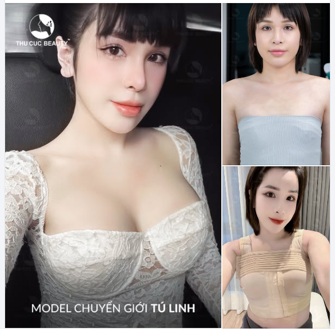 Bí quyết thoát ""lép” của các chị em chỉ sau 60 phút