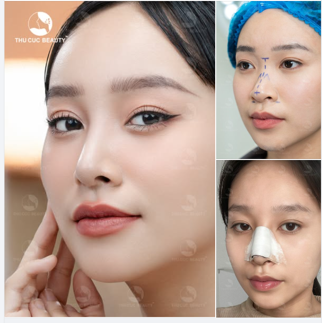 Ca sĩ Huyền Anh tự tin với góc nghiêng thần thánh sau 30P