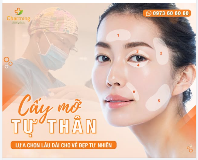 CẤY MỠ TỰ THÂN – KẾT QUẢ CÓ THỂ DUY TRÌ LÂU DÀI?
