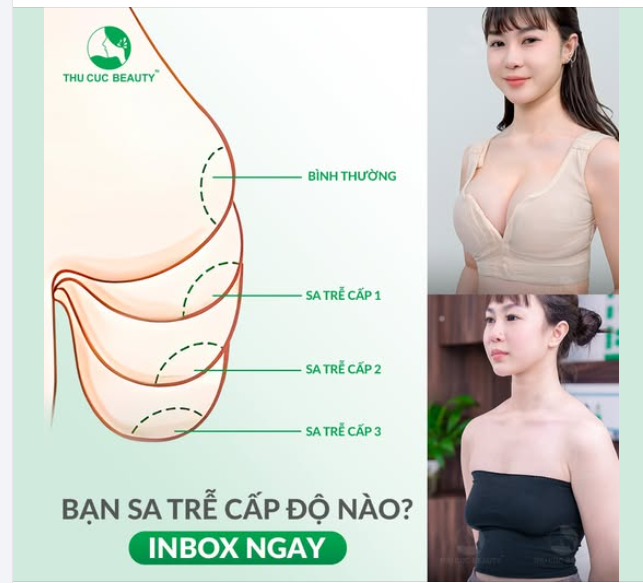Ngực TC 42.9Tr  Giải pháp vàng dành cho các chị em có V1 sa trễ