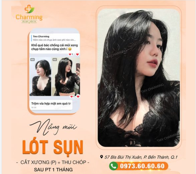 Nàng khách sau khi nâng mũi lót sụn, cắt xương và thu chóp mũi tại Charming đã có màn "lột xác" ngoạn mục!