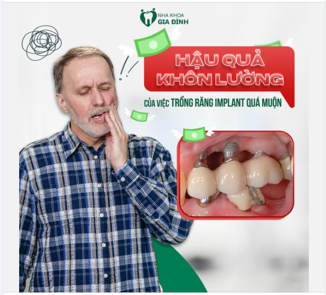 HẬU QUẢ KHÔN LƯỜNG CỦA VIỆC TRỒNG RĂNG IMPLANT QUÁ MUỘN