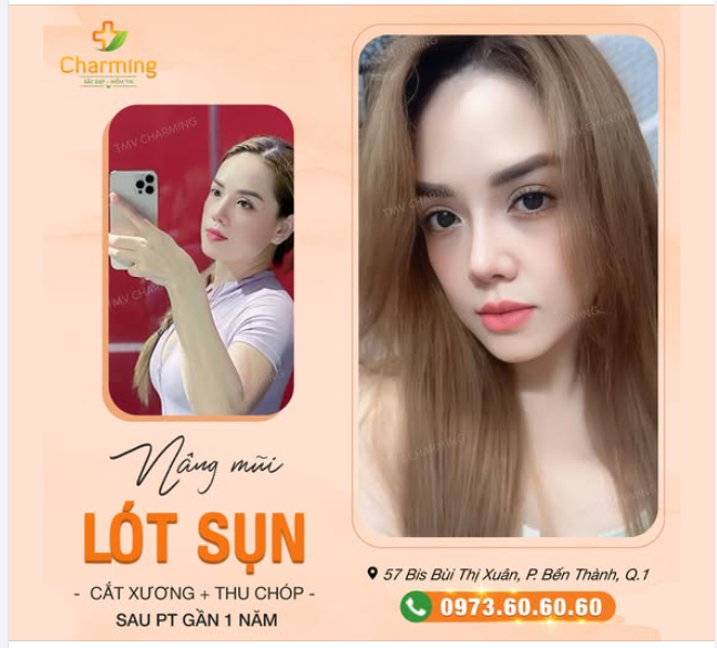 Nàng khách hàng xinh đẹp này đã lựa chọn nâng mũi lót sụn, cắt xương và thu chóp mũi tại TMV Charming, và kết quả thì không thể ấn tượng hơn.