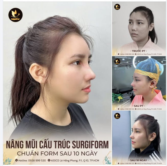 60 PHÚT THỰC HIỆN - 10 NGÀY ĐẸP CHUẨN FORM - KẾT QUẢ BỀN VỮNG