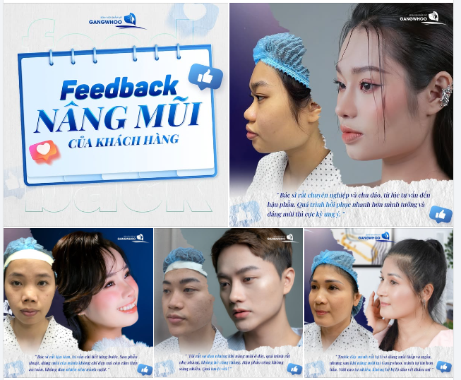Hơn 1000 khách hàng lựa chọn nâng mũi tại Bệnh viện thẩm mỹ Gangwhoo mỗi năm và để lại phản hồi hài lòng vì: