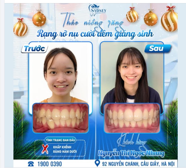 THÁO NIỀNG RĂNG - RẠNG RỠ NỤ CƯỜI ĐÊM GIÁNG SINH