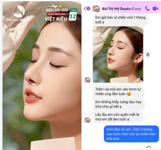 Feedback nâng mũi siêu yêu của khách hàng