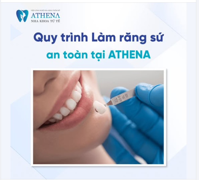 Răng sứ thẩm mỹ tại Nha Khoa ATHENA giúp bạn có được nụ cười tự tin, đẹp tự nhiên và bền lâu.