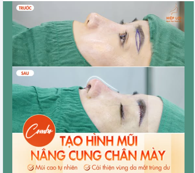 COMBO TẠO HÌNH MŨI NÂNG CUNG CHÂN MÀY