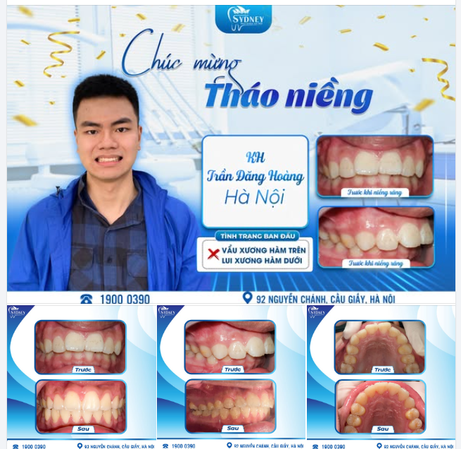 CHÚC MỪNG THÁO NIỀNG KH. ĐĂNG HOÀNG