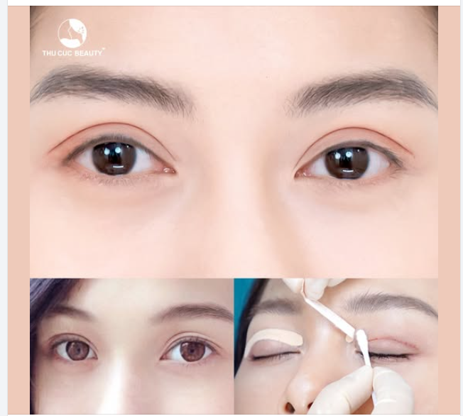  Mí nét từng milimet chỉ sau 15P thực hiện