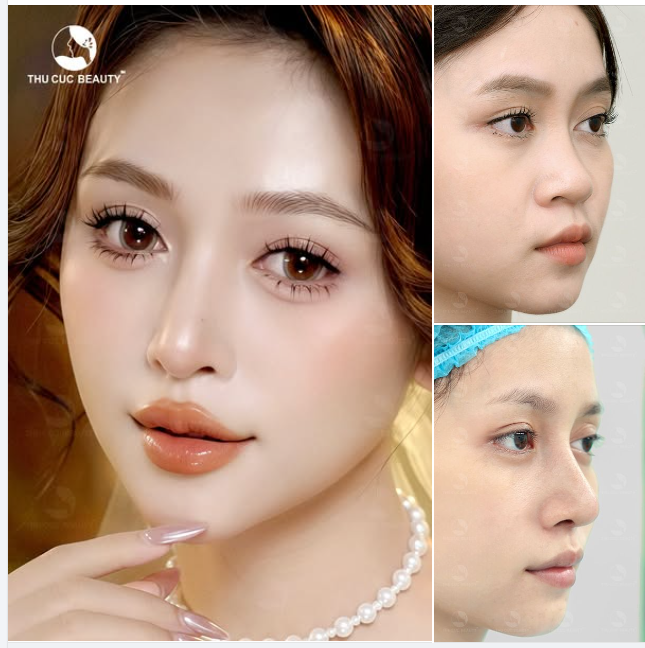 Có ngay chiếc mũi phong thủy sau 30 phút