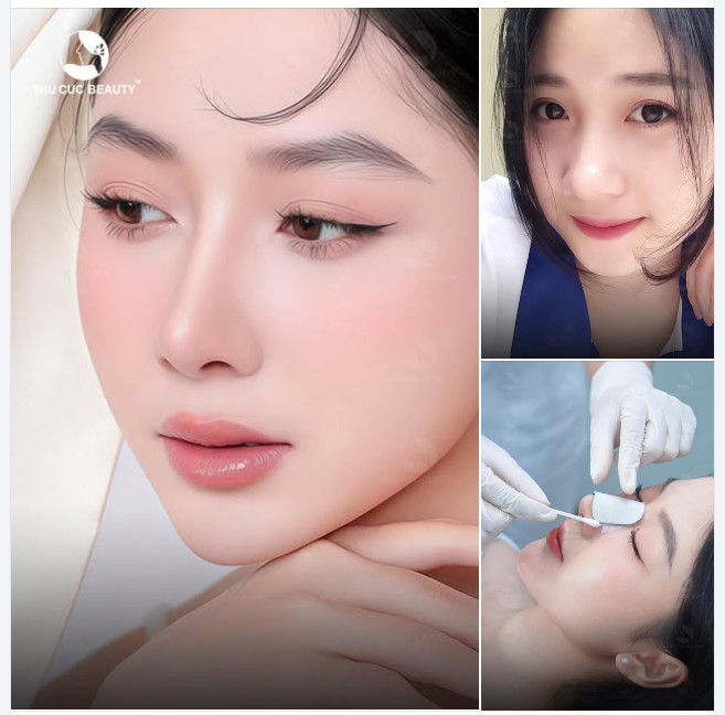 Chào đón diện mạo mới cùng dáng mũi cao thanh tú
