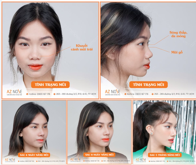 Công việc phát triển, thu nhập tăng lên và được thử sức trong các lĩnh vực MC, người mẫu, KOLs... chính là "quả ngọt" sau 5 tháng thay đổi của cô sinh viên tài năng P.L.