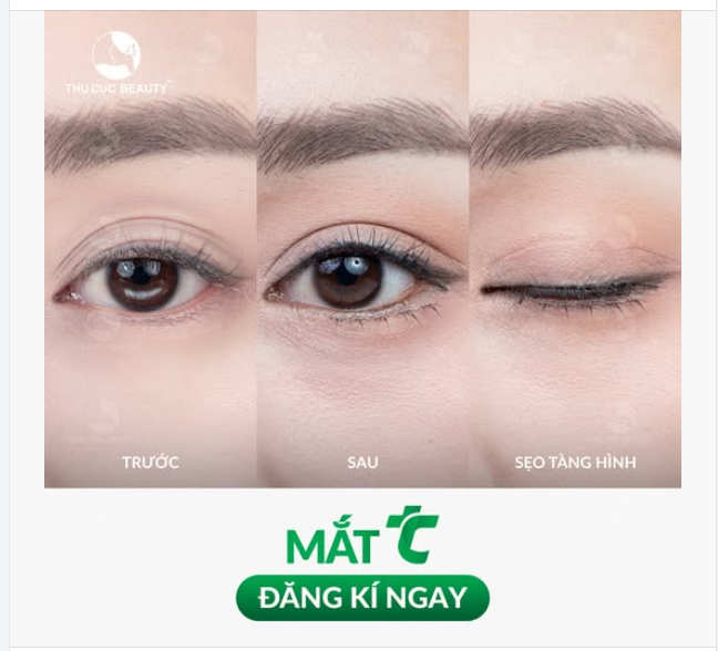 Đẹp kịp Tết cùng Mắt TC 5.9Tr
