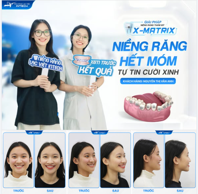 TẠM BIỆT QUÁ KHỨ RĂNG MÓM, CẮN NGƯỢC, CHÀO ĐÓN TƯƠNG LAI RẠNG RỠ!