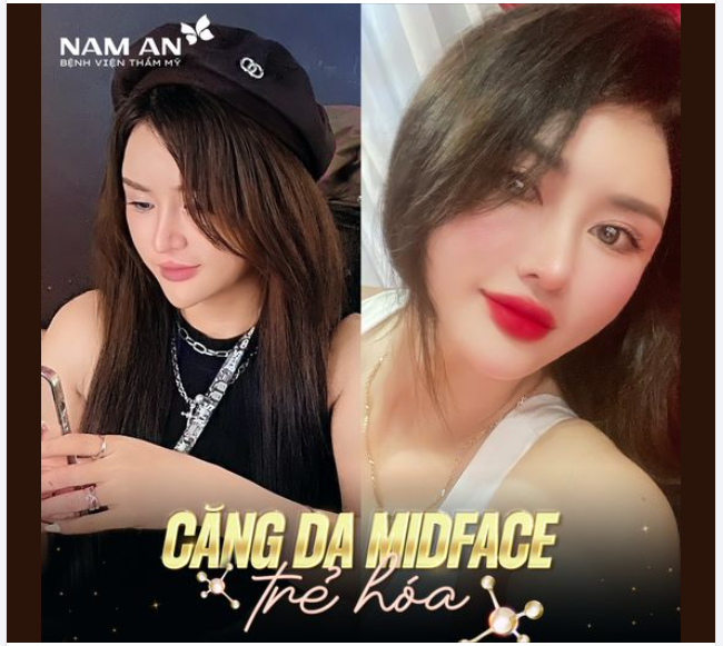 FEEDBACK KHÁCH HÀNG TRẺ TRUNG NHỜ CĂNG DA