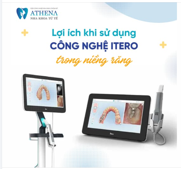 Lợi ích sử dụng công nghệ iTero trong niềng răng