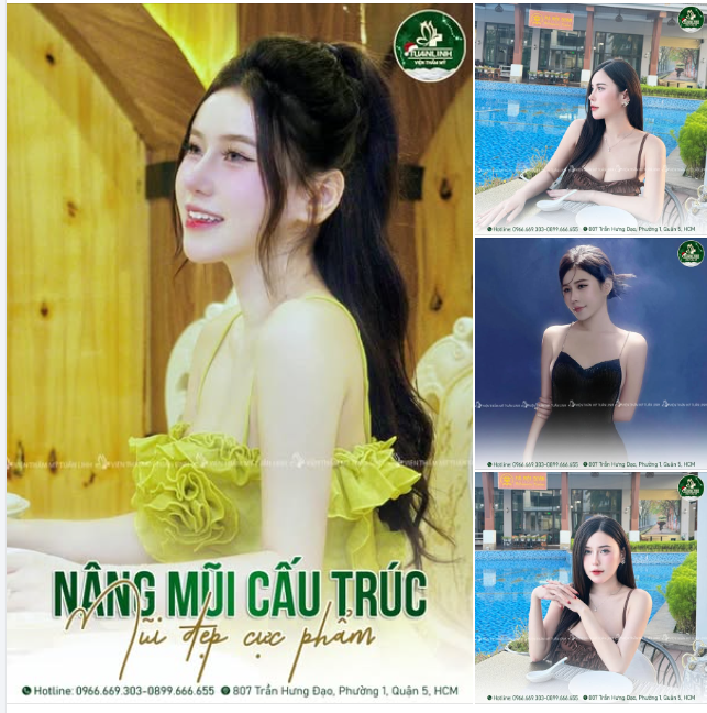 Nâng mũi cấu trúc - Mũi đẹp chuẩn Hotgirl!!