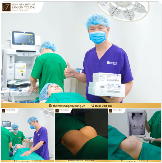 Nâng ngực là vì chồng.