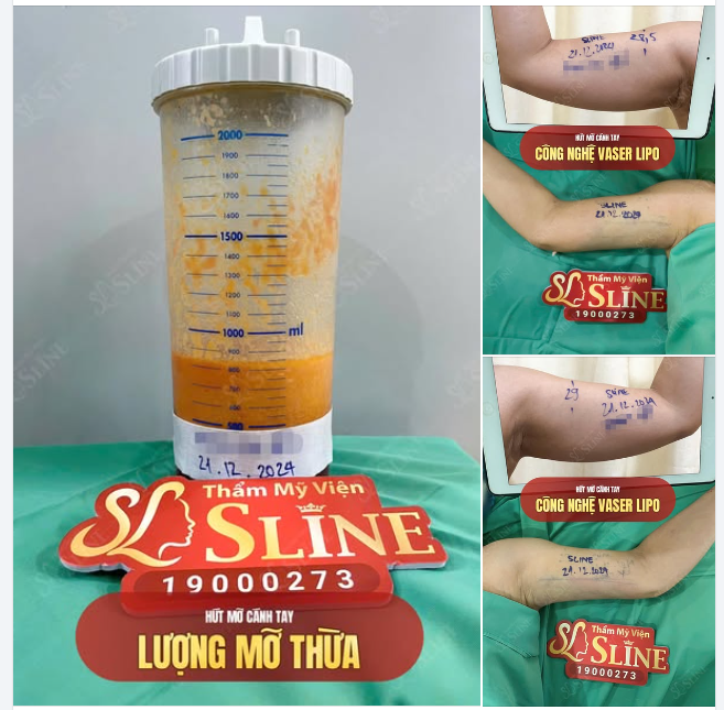 TAY THON - MẶC GÌ CŨNG ĐẸP  ĐÚNG VẬY