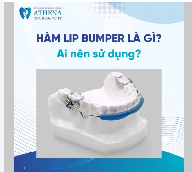 Hàm Lip Bumper là gì? ai nên sử dụng?