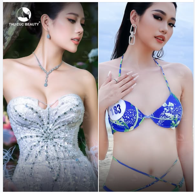 Xinh đẹp, hấp dẫn thế này tại sao không quyết định nâng v1 từ sớm