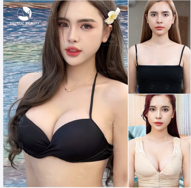 Ngực TC Dáng linh hoạt - Không bao xơ - Thoải mái vận động