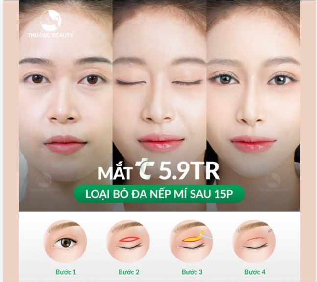 Kỹ thuật hiện đại bác sĩ tay nghề cao bạn yên tâm khi đến TC